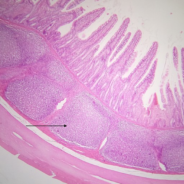 Anatomy, Physiology & Pathology - Swollen Abdominals and the Lymphatic ...